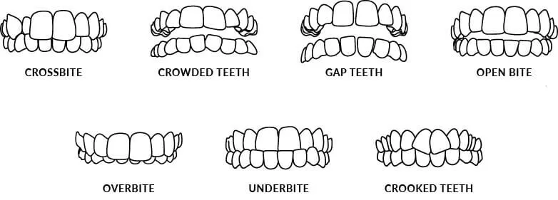 Orthodontic device