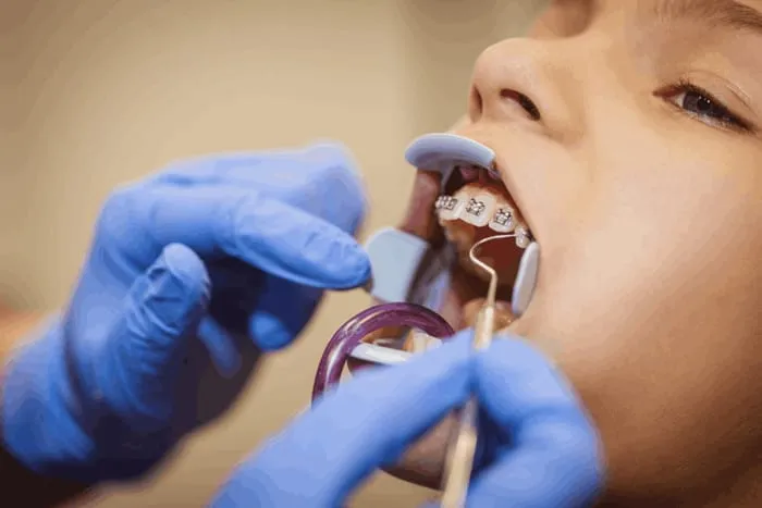 Free orthodontic Consultation for children