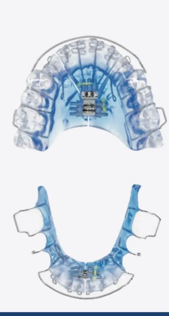 Vivos a Non-Invasive Solution