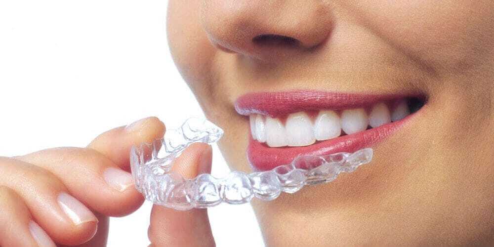 Invisalign Invisalign