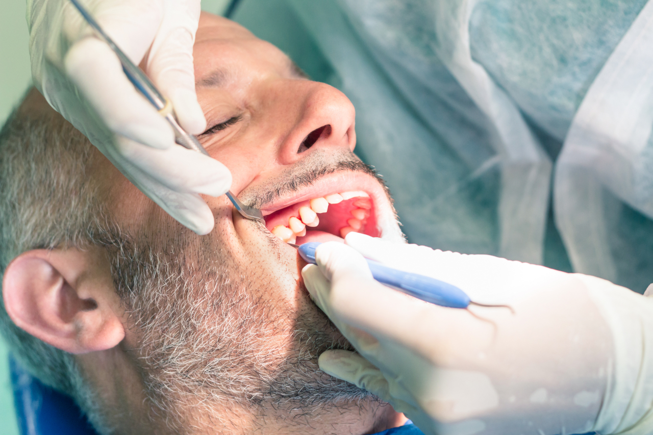 Featured image for “Broken or Chipped Tooth in Leduc: What to Do and When to See an Emergency Dentist”
